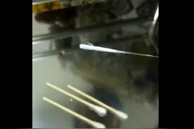 6个月宝宝眼睛里取出4条活虫！医生：主要从宠物身上传染而来图片