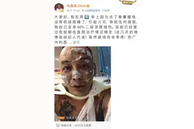 说唱歌手点香薰蜡烛导致全身40%烧伤，他的这个习惯很多人都有图片