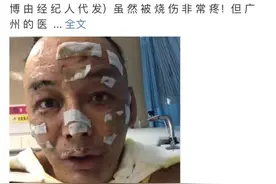 说唱歌手点香薰蜡烛导致全身40%烧伤，他的这个习惯很多人都有图片