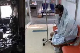 歌手没熄灭蜡烛睡觉致住所失火，全身二级深度烧伤视频封面