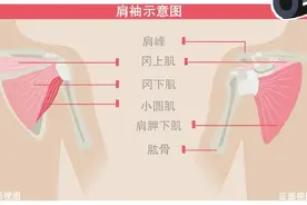 肩疼未必肩周炎，这种病偏爱“勤快人”图片