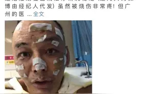 说唱歌手点香薰蜡烛导致全身40%烧伤，睡前一定要熄灭，避免意外图片