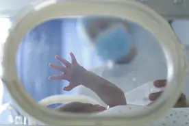 揪心！美国剖腹产手术致女婴毁容，已缝合13针未来还需整形图片