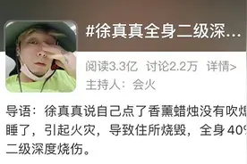 男歌手住所烧毁，全身40%深度烧伤！这个习惯很多人都有图片