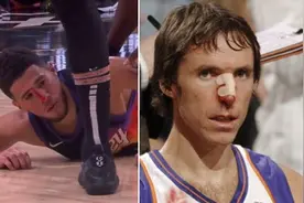 美媒对比07年纳什和今日布克鼻梁出血 现场球迷T恤“神预言”图片