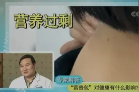 营养过剩，缺乏锻炼？小心脖子后面长“富贵包”图片
