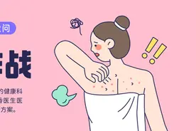 黑头千万别挤！教你一招 KO 它图片