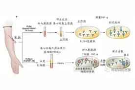 T-SPOT检查在诊断结核中到底有多大意义？图片