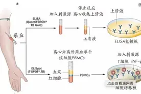 T-SPOT检查在诊断结核中到底有多大意义？图片