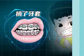 摘了牙套就算完成牙齿正畸？不，还需要戴牙齿保持器图片
