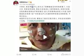 警惕 | 小小香薰居然有这么大的隐患，网红明星被二级深度烧伤图片