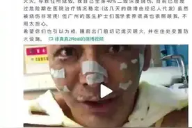 警惕 | 小小香薰居然有这么大的隐患，网红明星被二级深度烧伤图片