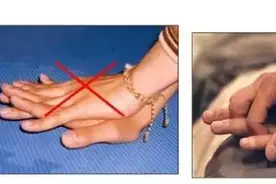 技多不压身，这些夏季常用的急救知识，赶紧学起来吧图片