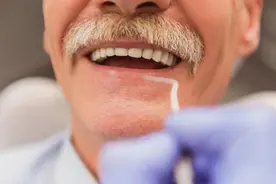 走出种植牙误区，给老人第三副牙齿图片