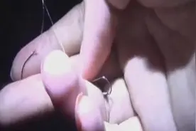 拉杆太猛鱼竿断裂 鱼钩“打中”围观男子右眼……差点失明图片