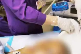 广东女孩头长虱子，妈妈竟用农药焗头驱虱……结果中毒险丧命图片