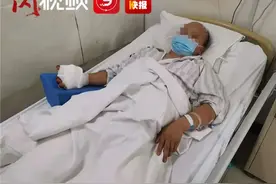 神奇！男子大拇指被切断，西安医生取脚趾补手指图片