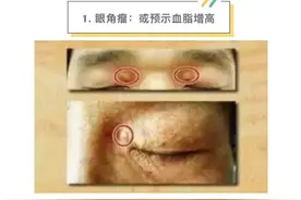 这几个面相要当心，很可能是疾病征兆图片