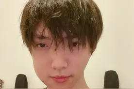 赵磊拔完智齿后肿成面包脸 粉丝：虽然心疼你但还是忍不住想笑图片
