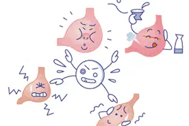 胃不舒服、反酸、烧心…试试这个新妙招，有用图片
