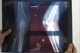 骑车时被狗撞倒受伤 狗主人应承担责任图片
