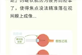 近视、散光、老花眼……到底有什么不同，眼科医生一句话告诉你图片