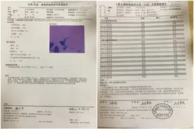 宫颈癌是最温顺的野兽，早期信号要警惕图片