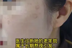 【提醒】熬夜10年，竟长出老年斑？夏日祛斑得这样做→图片