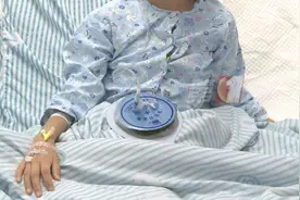 广东一女孩腹痛难忍，一查惊呆：体内竟有一团密密麻麻的头发…图片