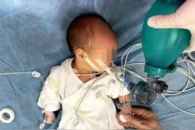 7天大宝宝疑呛奶窒息，呼吸心跳骤停，医护人员坚持抢救1小时终救回一命图片