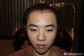 张碧晨插足？网友自曝与华晨宇关系 晒其整容旧照图片
