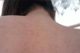 太上头了！经常爆痘，医生推荐这种食物泡水喝……图片