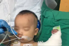 三个月大孩子断了胳膊，这是医生见过全国最小的不全断臂患者图片