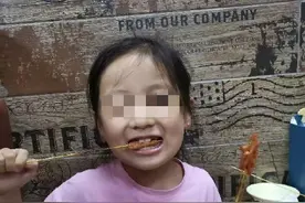 大面积烧伤后能不能喝水图片