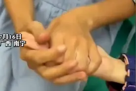 两个孩子遭恶作剧，手掌被502胶水牢牢粘住图片