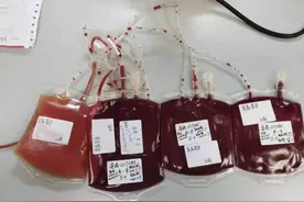 “熊猫血”妈妈生二胎引起了多个医生的关注！妊娠全周期得到保驾护航，母子平安图片