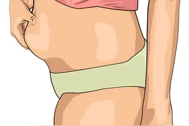 吸脂手术真的那么危险吗？哪些人不宜做？医生解答来了——图片