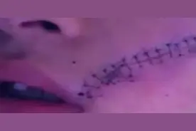 “男孩开冰可乐被炸缝38针”疑似旧闻，碳酸饮料应妥善贮存图片