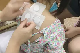 健康在线｜小儿“三伏贴”受热捧，哪些小儿适合“三伏贴”？图片