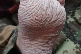 辛苦了！河南抗洪官兵皱起发白的脚图片