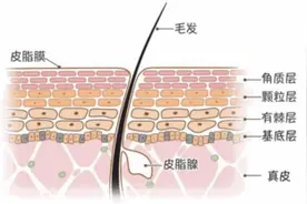 痱子痒、红屁屁、淹脖子……怎么办？夏季儿童护肤宝典来啦图片