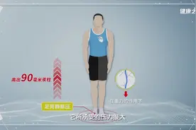腿肿不是病，但久坐久站可能会引发严重的后果图片