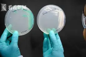 能人传人且致命！美国出现“超级真菌”群体感染 已致多人死亡图片