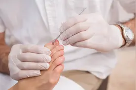 包治甲沟炎、灰指甲？记者探访修脚店：嵌甲矫正贴片价格翻两百倍图片