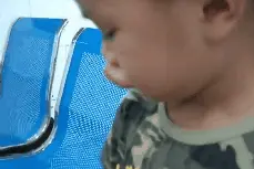 注意！孩子严重过敏，这样做才能保命！图片