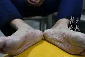 让人心疼的脚，消防员奋战30小时排除内涝，脚被泡到起皱发白图片