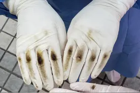 还记得荔湾封闭区敲门手指发淤的护士吗？她收到了迟到的仙女棒图片
