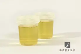 尿中有一层泡沫，是得肾病了？小便泡沫多，可能还暗示这些问题图片