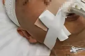 脑出血后昏迷100天，上海冬雷脑科医院综合促醒治疗让他醒来图片