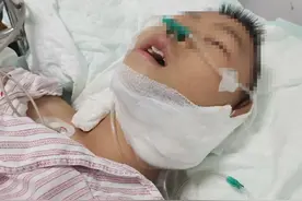 孩子看金鱼时跌落割破颈动脉，多学科联合修补大血管救下孩子图片
